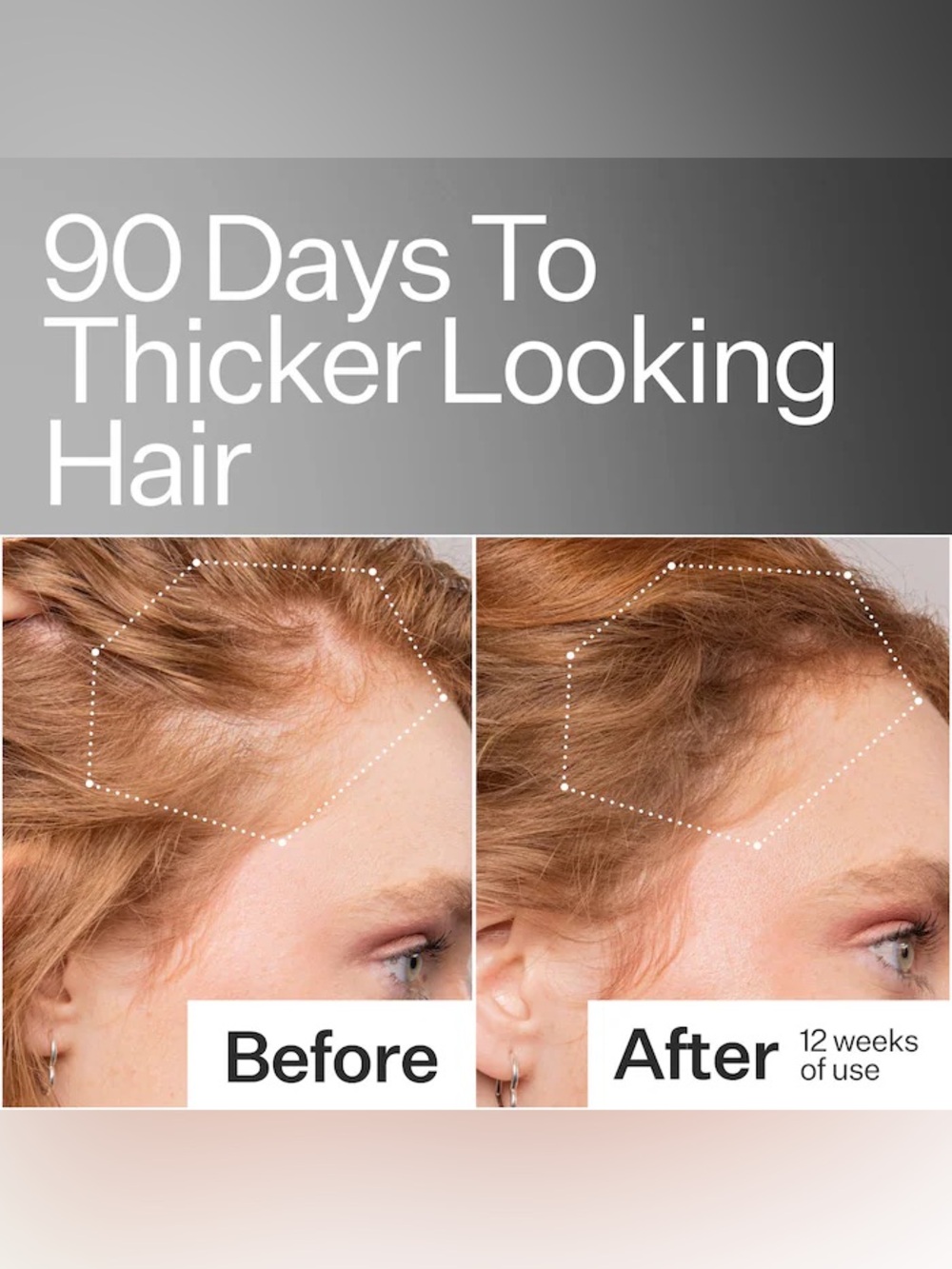 Act+Acre
2% Stem Cell H-2 Grow Complex ™ Scalp Serum New without box - Picture 4 of 7